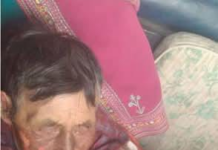 Un adulto mayor de 85 años sufrió severas quemaduras al entrar en contacto con un cable de alta tensión que llevaba varios días en el suelo sin ser retirado, lo que ha dejado al descubierto las graves deficiencias