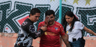 Edison Pilataxi, un joven aficionado de la Liga Deportiva Universitaria de Quito, fue herido gravemente por el impacto de una bala de goma disparada por un miembro de la Policía Nacional, lo que le provocó la pérdida total de su ojo derecho. Este hecho ha motivado la apertura de una investigación conjunta entre la Fiscalía General del Estado y la LigaPro.