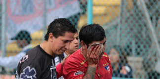 Durante el partido entre LDU y Deportivo Cuenca en el estadio Alejandro Serrano Aguilar, un hincha del equipo quiteño sufrió la pérdida de su ojo derecho tras recibir el impacto de una bala de goma disparada por la Policía Nacional en medio de disturbios en las gradas.